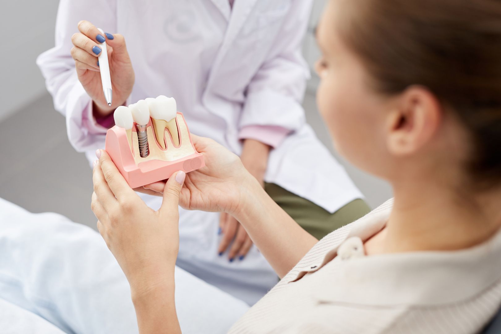 Como Funciona o Procedimento de Implante Dentario 1